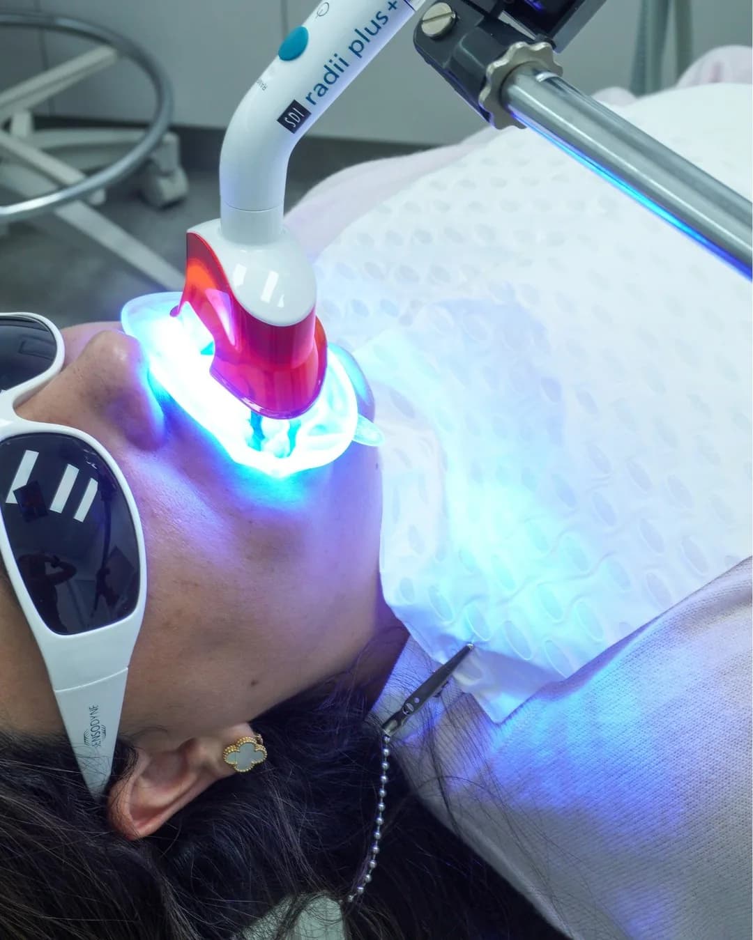 A blue curing light held to a patient’s teeth