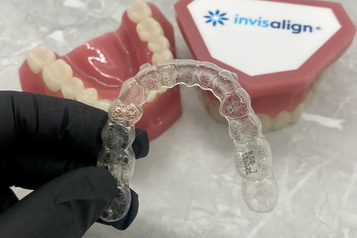 A clear aligner held beside a model of teeth