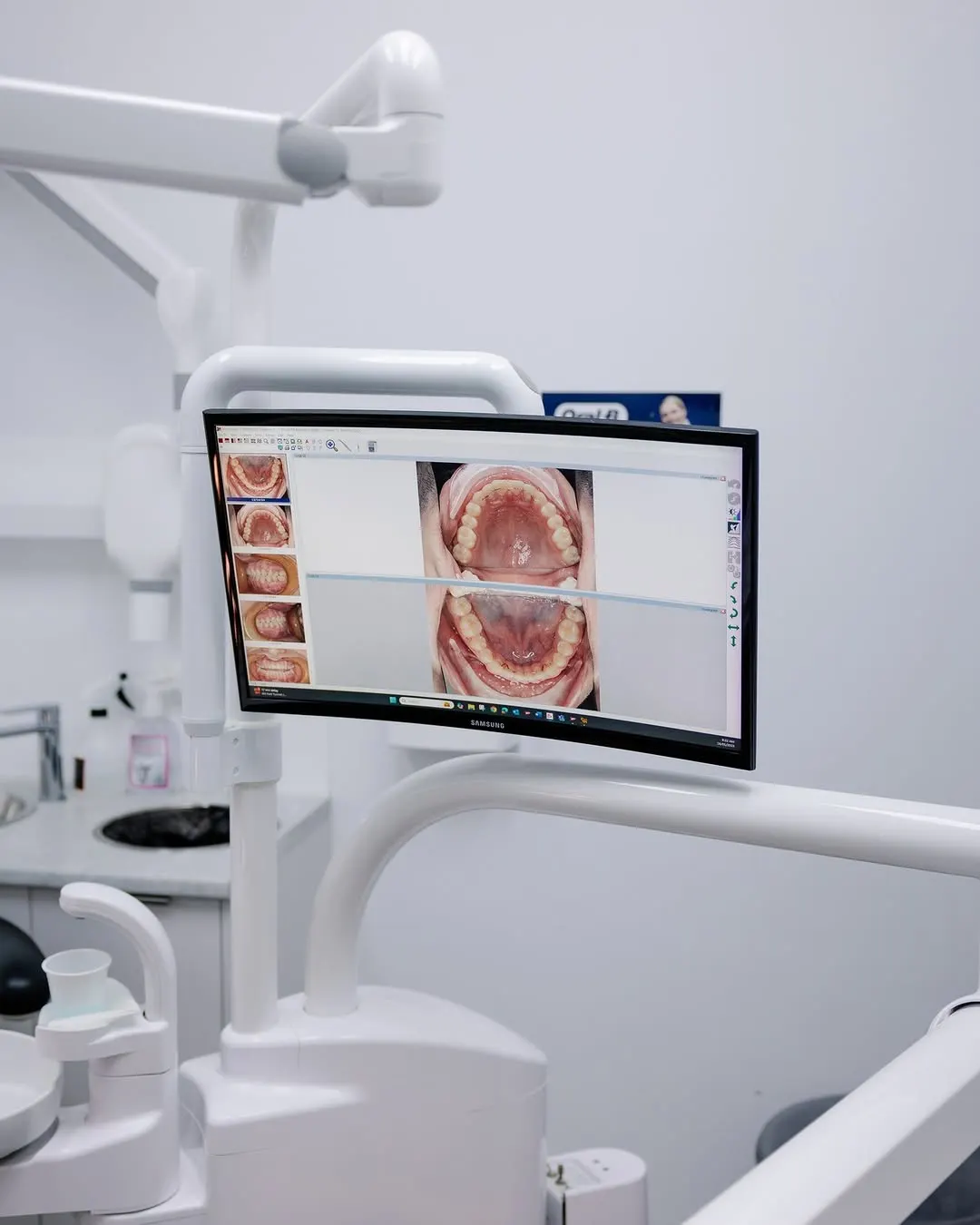 A chairside monitor showing intraoral photos of the upper and lower teeth