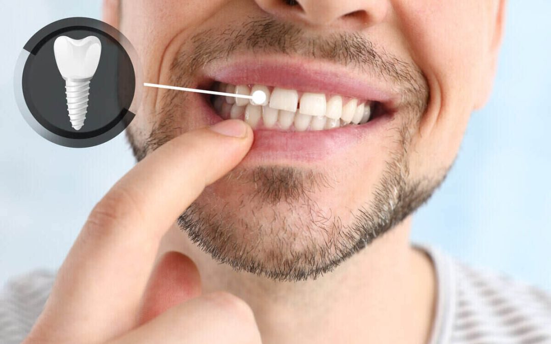 The Best and Worst Foods for Your Teeth